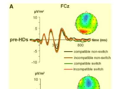 Multitasking and fronto-striatal circuits