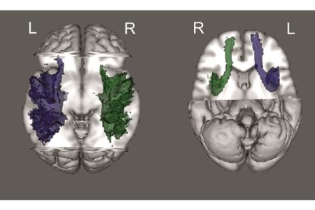 How white matter influences functional asymmetry